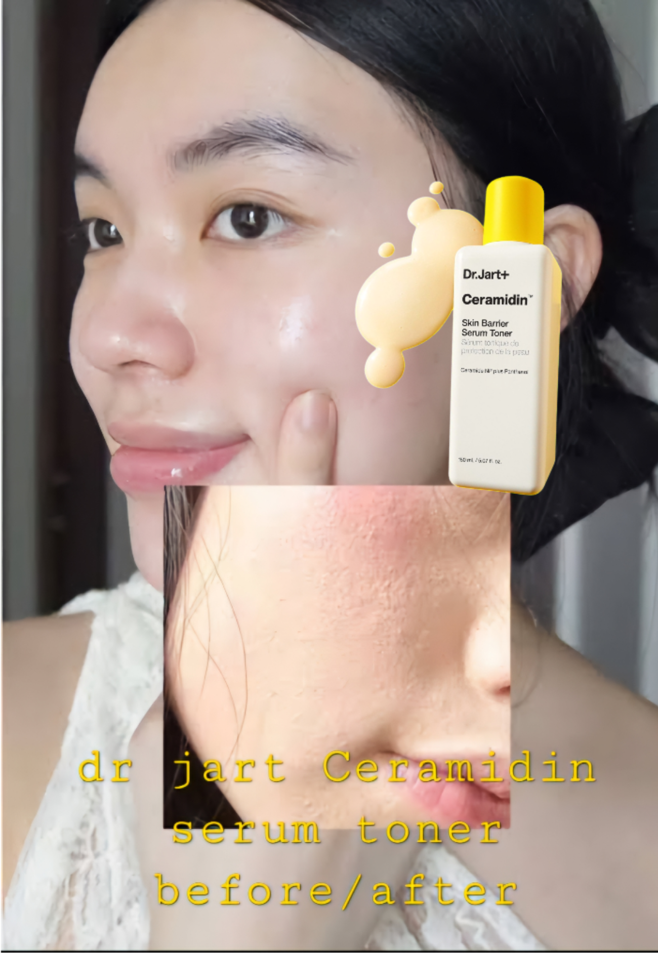 Before and After Using Dr Jart Ceramidin Skin Barrier Serum Toner