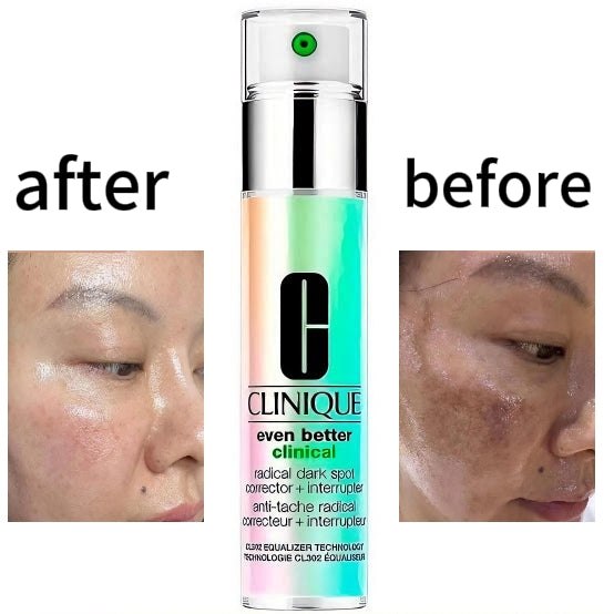 Clinique skincare product with 'before' and 'after' skin comparisons
