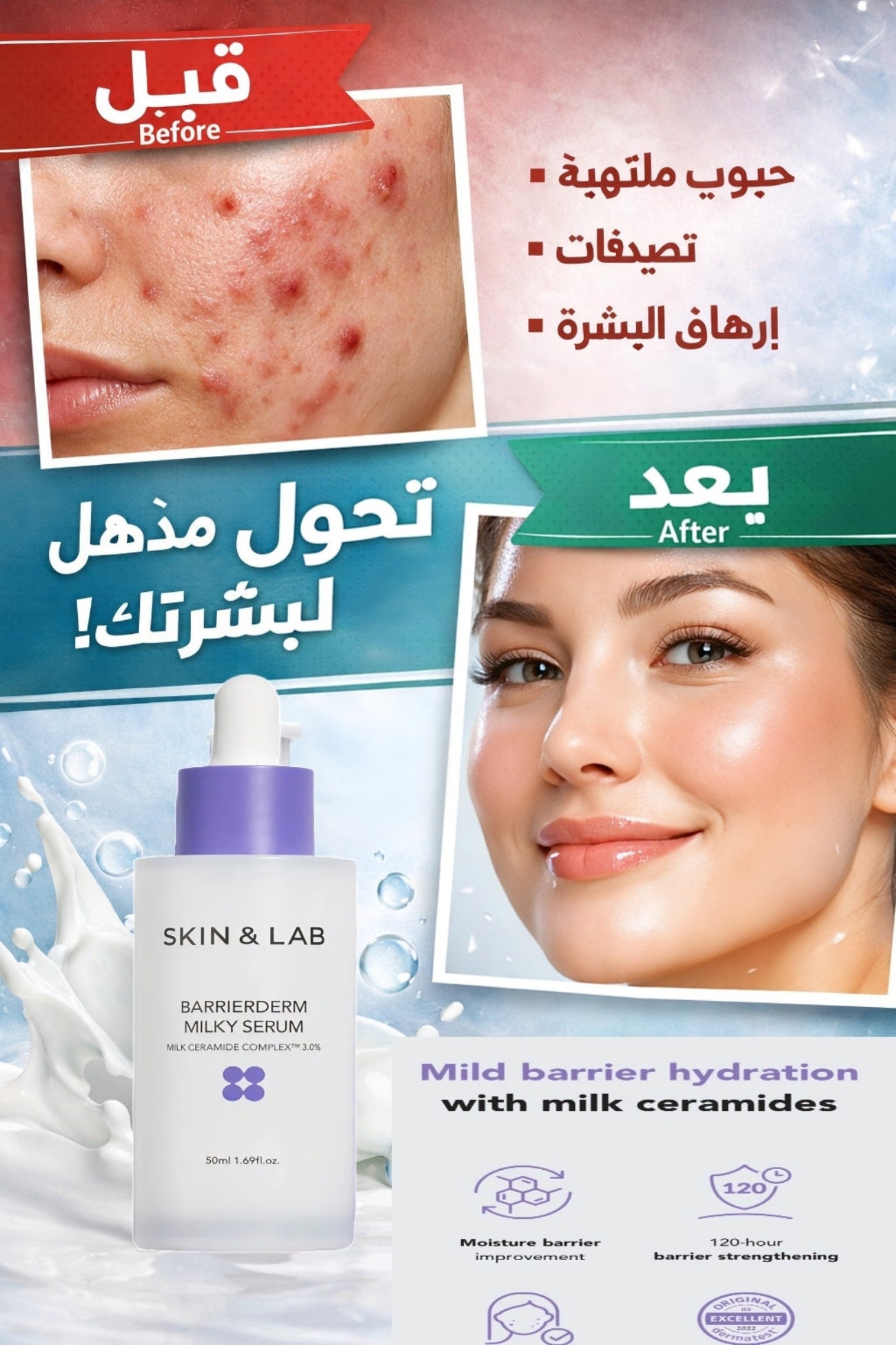 Before & after skin & lab Barrierderm Milky Serum Korean skincare 