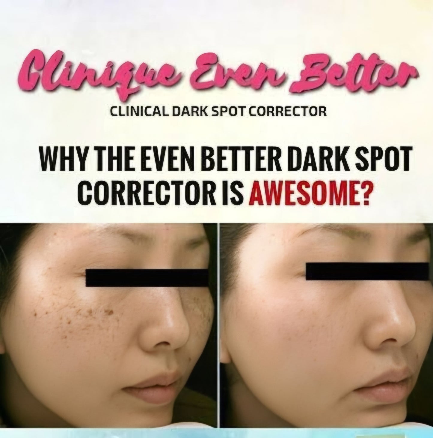 Clinique Even Better Clinical Dark Spot Corrector showing before and after effects on skin.