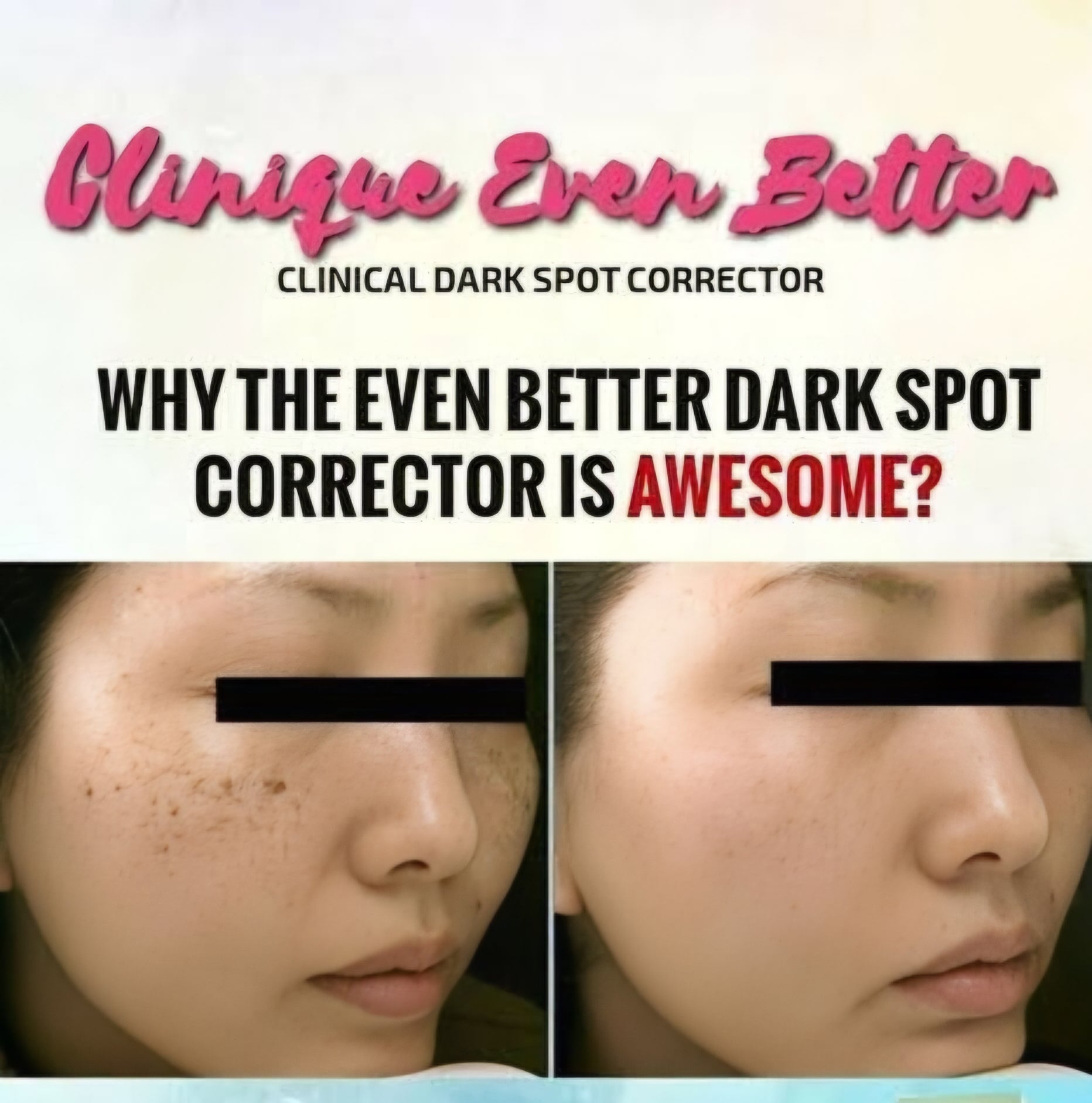 Clinique Even Better Clinical Dark Spot Corrector showing before and after effects on skin.