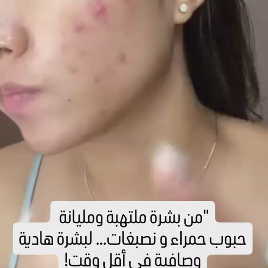 Skin &lab Barrierderm Milky Serum Korean Skincare 