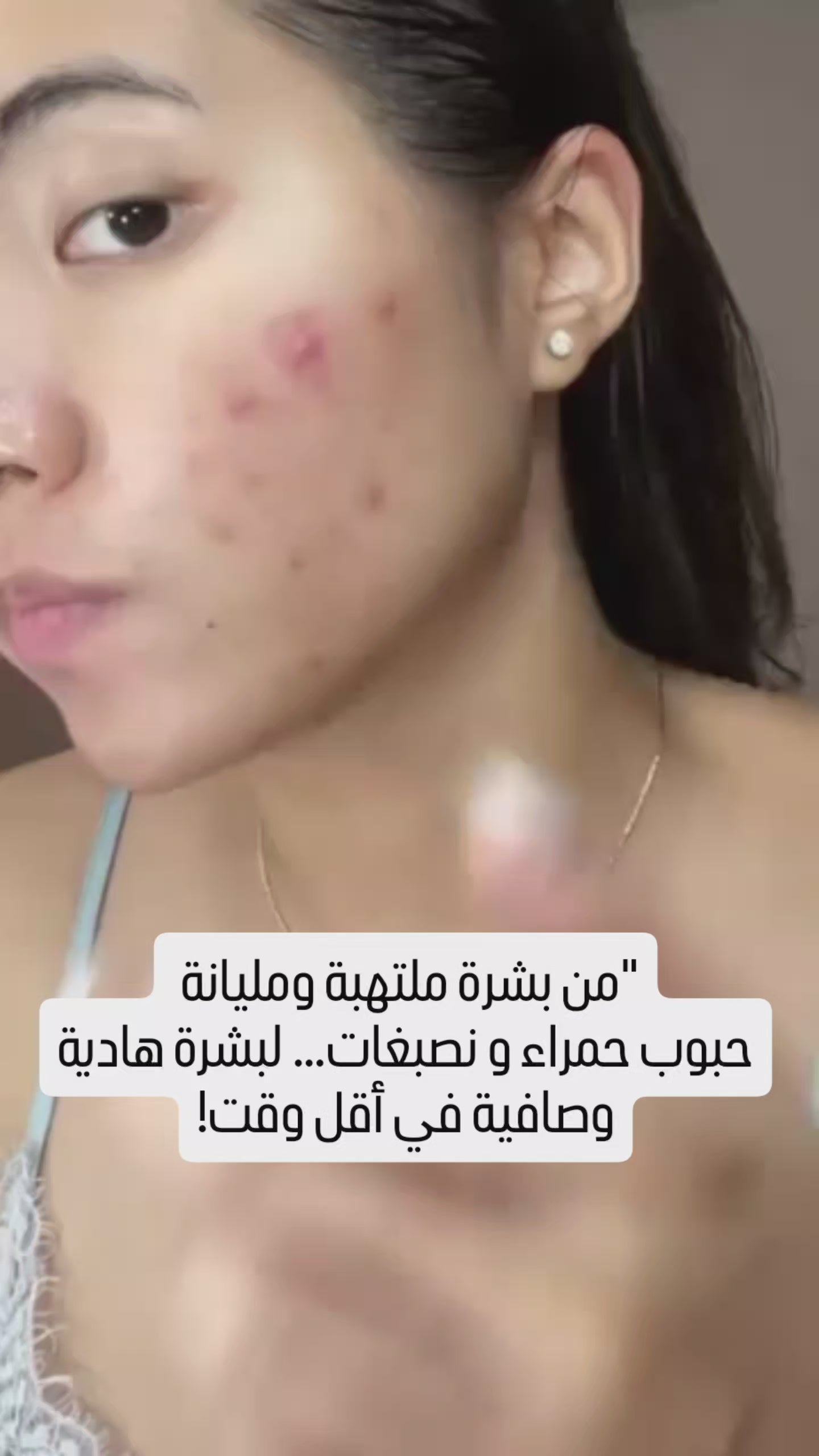 Skin &lab Barrierderm Milky Serum Korean Skincare 
